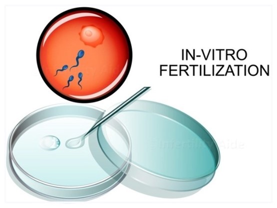 IVF3